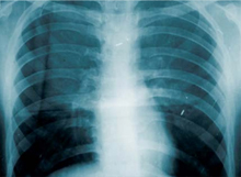 Fokus-og-handling-giver-mindre-sygdom