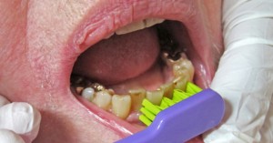 Hjaelp-de-aeldre-med-at-boerste-taender